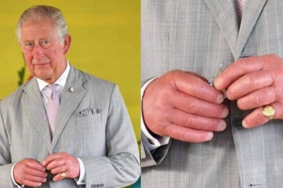 Por que o rei Charles tem “dedos de salsicha”?