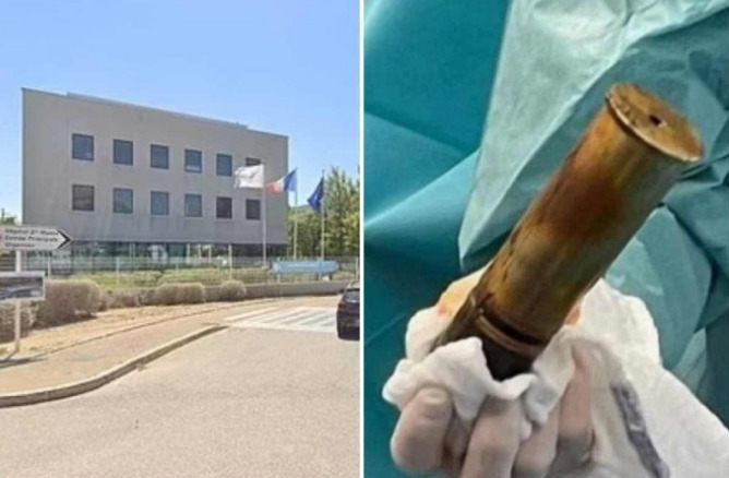 Homem dá entrada em hospital com bomba no ânus e local tem de ser esvaziado