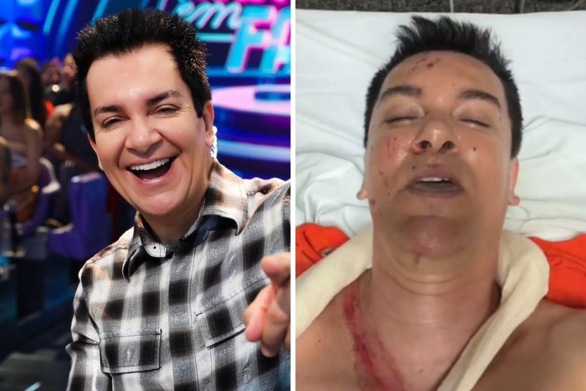 Regis Danese sofre acidente e grava vídeo sangrando: 'Orem por mim'