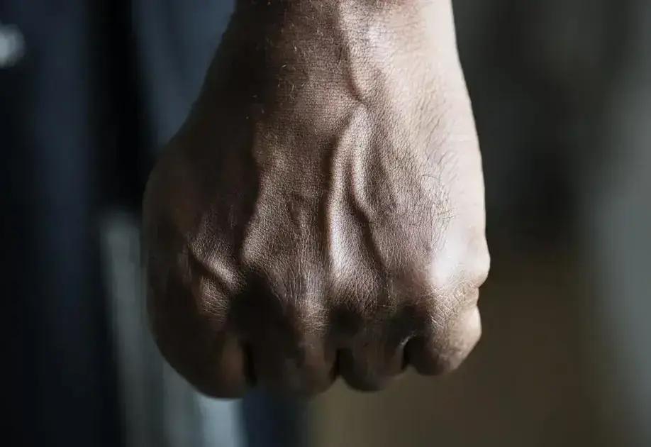 Agressão em Ipatinga: mulher agredida após pegar celular do ex