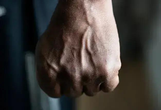 Homem de 59 anos sofre agressão em bar no Setor 7 de Timóteo