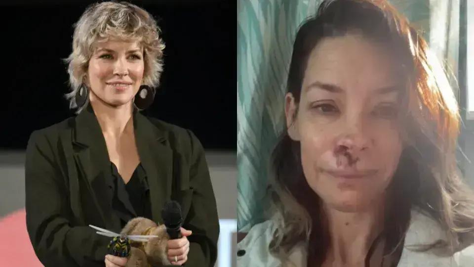 Evangeline Lilly, famosa por 'Lost', revela acidente grave na praia